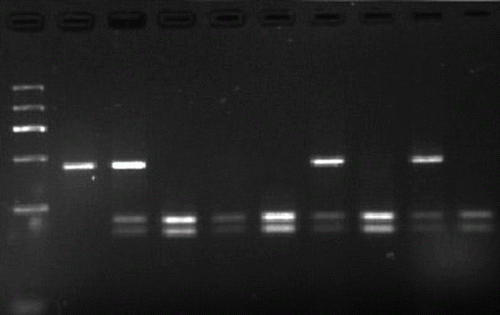 Figure 2.  HinfI digestion patterns of PCR products. Lane 2= genotype AA(451bp);Lanes 3,7,9 = genotype AB(451, 244 and 207bp); Lanes 4,5,6, 8, 10 = genotype BB(244 and 207bp);Lane 1= marker (1200, 900, 700, 500, 300, and 100bp).