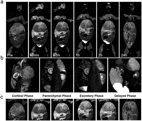 Figure 3 In vivo postcontrast MR images of the Gd@BSA NPs over time. (a) Coronal T1-weighted MR images acquired from rabbits injected with Gd@BSA NPs at a Gd dose of 0.02 mmol/kg body weight. Precontrast and 10 min, 0.5 h, 1 h, 2 h and 24 h postcontrast images are shown from left to right. (b) Dynamic multiphase enhanced MR images of the kidneys from rabbits administered Gd@BSA NPs. (c) T1-weighted MR images of the livers from rabbits injected with Gd@BSA NPs.