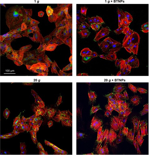 Figure 2 Immunofluorescence staining. Vinculin (green) and F-actin (red) in proliferating mesenchymal stem cells after the 3-hour treatment. Nuclei counterstained in blue.Abbreviation: BTNPs, barium titanate nanoparticles.