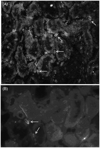Figure 6. Indirect immunofluorescence analysis of renal CD8+ lymphocytes in HgCl2-induced nephropathy. (a) An increased presence of interstitial CD8+ cells (arrows) in tissue from HgCl2 only-treated rats. (b) Co-treatment with Losartan led to a decrease in numbers of these cells (arrows) relative to that in HgCl2 only-treated rats. Rats in Groups IV, V and VI presented with normal tissues and so micrographs are not shown. Representative micrographs are presented. Original magnification = 400×.