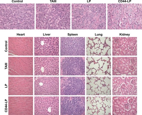 Figure 6 Histological characteristics of tumor and representative organs excised from HepG2 tumor-bearing mice following a 30-day treatment with PBS (control), free TAIII, LP, and CD44-LP.Note: The images were obtained using a digital microscope at 400× magnification.Abbreviations: LP, liposomes; TAIII, timosaponin AIII.