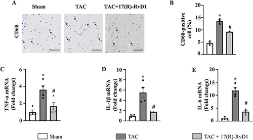 Figure 4 17(R)-Resolvin D1 reduces inflammatory cytokine production and the infiltration of inflammatory cells induced by pressure overload in cardiac tissue. Infiltration of CD68+ macrophages (A and B) in the heart in different groups (n=3) (Scale Bar, 40μm), the black arrowheads indicate CD68-positive cells. The mRNA levels of pro-inflammatory cytokines tumor necrosis factor-α (TNF-α) (C), interleukin (IL)-1β (D), and IL-6 (E) were assessed in cardiac tissue (n=4). The data were analyzed using One-way ANOVA followed by Tukey’s post hoc test. Data are presented as the mean ± SEMs. *P < 0.05 compared with the Sham group, #P < 0.05 compared with the TAC group.