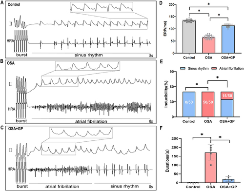 Figure 2 Impact of Obstructive Sleep Apnea (OSA) on Atrial Electrical Stability and Susceptibility to AF. (A–C) Representative images demonstrate the induction of AF using burst pacing with a 50 ms S1-S1 interval across the three experimental groups. (D) Serial measurements of the effective refractory period (ERP) were conducted five times per animal in each group (n= 5 per group). (E) AF inducibility was assessed repetitively ten times per animal in each group (n= 5 per group). (F) The cumulative durations of AF episodes during AF induction were recorded (n= 5 per group). The statistical significance (*P < 0.05) indicates notable differences observed between the groups.