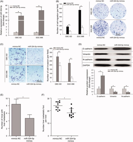 Figure 2. Overexpression of miR-324-5p inhibits cell migration, invasion and EMT in vitro and impedes the metastasis of GBC cells in vivo. (A) GBC-SD and SGC-996 cells were transfected with miR-324-5p mimics or mimics negative control (mimics NC), and the expression level of miR-324-5p was analyzed by quantitative RT-PCR assay after transfection. (B) Transwell migration assay was performed to compare the cell migration of miR-324-5p overexpression in GBC-SD and SGC-996 cells (200×). (C) Transwell invasion assay demonstrated the suppressive cell invasion ability of miR-324-5p mimics compared to the mimics NC in GBC-SD and SGC-996 cells (200×). (D) The protein levels of E-cadherin, N-cadherin, and Vimentin in SGC-996 cells were determined by Western blot analysis after transfected with miR-324-5p mimics or mimics NC. (E) Number of liver metastasis at the 42nd day after mice following intra-splenic injection of stably transfected with miR-324-5p mimics or mimics NC. (F) H&E staining of the metastatic foci in the liver, and number of metastatic foci per liver was calculated and compared. All experiments were performed three times and data were presented as mean ± SD, *p < .05.