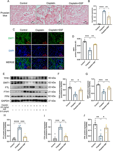 Figure 9 SSF attenuates abnormal iron metabolism in cis-AKI mice. SSF attenuates abnormal iron metabolism in cis-AKI mice. (A and B) Representative images of iron deposition by Prussian blue staining and its quantitative analysis. Magnification: 400×. (C and D) Representative images of DMT1 expression by IF and its quantitative analysis. Magnification: 400×. (E) The expressions of TFR1, DMT1, FTL, FTH1, and FPN by WB (n=4 in each group). (F-J) The quantitative analysis of TFR1, DMT1, FTL, FTH1, and FPN by WB. All data are shown as mean ± SEM (one-way ANOVA). *p<0.05, **p<0.01, ***p<0.001, ****p <0.0001.