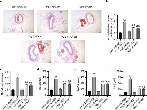 Figure 7. DEX attenuates Ang II-induced AAA and inflammation in mice. (a) Representative images of HE staining for histopathological observation of murine abdominal aortic tissue. (b-c) Abdominal aortic diameter and media/lumen ratio of each group. (d-f) ELISA for determining the concentrations of proinflammatory cytokines in murine abdominal aortic samples. n = 10 mice/group. Each experiment was performed in triplicate. **p˂0.01 vs. control+ DMSO group; #p˂0.05, &p˂0.05vs. Ang II+ DMSO group.