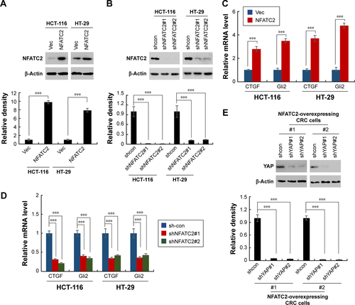 Figure S3 NFATC2 regulates Hippo/YAP signaling pathway. (A) Characterization of NFATC2-overexpressing HCT-116 and HT-29 cells. (B) Characterization of NFATC2-knockdown HCT-116 and HT-29 cells. (C) qRT-PCR analysis of CTGF and Gli2 in NFATC2-overexpressing HCT-116 and HT-29 cells. (D) qRT-PCR analysis of CTGF and Gli2 in NFATC2-knockdown HCT-116 and HT-29 cells. (E) Characterization of YAP-knockdown NFATC2-overexpressing CRC cells.