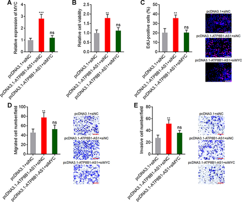 Figure 8 Depletion of MYC reverses the oncogenic roles of ATP8B1-AS1 in HCC. (A) MYC expression in SNU-398 cells with ATP8B1-AS1 overexpression and MYC silencing was measured by qPCR. (B) Cell proliferation of SNU-398 cells with ATP8B1-AS1 overexpression and MYC silencing was measured by Glo cell viability assay. (C) Cell proliferation of SNU-398 cells with ATP8B1-AS1 overexpression and MYC silencing was measured by EdU incorporation assays. Red color represents EdU-positive and proliferative cells. Scale bars = 100 µm. (D) Cell migration of SNU-398 cells with ATP8B1-AS1 overexpression and MYC silencing was measured by transwell migration assays. Scale bars = 100 µm. (E) Cell invasion of SNU-398 cells with ATP8B1-AS1 overexpression and MYC silencing was measured by transwell invasion assays. Scale bars = 100 µm. Results are presented as mean ± SD based on three independent experiments. **P < 0.01, ***P < 0.001, by one-way ANOVA followed by Dunnett’s multiple comparisons test.