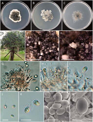 Figure 7. Morphology of Phyllosticta gwangjuensis. (A) Colonies on PDA; (B) Colonies on MEA; (C) Colonies on OA; (D) Torreya nucifera as host plant; (E, F) Conidiomata; (G–I) Conidiogenous cells and conidia; (J–M) Conidia; (L, M) SEM (scale bars: E = 2 mm; F = 1 mm; G, H = 20 μm; I–L = 10 μm; M = 5 μm).