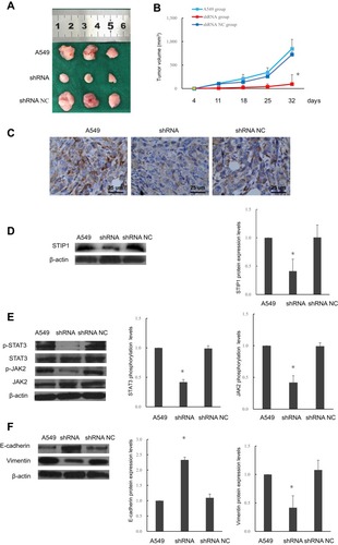 Figure 5 Effects of STIP1 on tumorigenesis in nude mice and associated mechanisms. (A, B) Tumor growth in nude mice injected with A549 lung adenocarcinoma cells transfected with STIP1 shRNA was reduced compared with that in nontransfected cells and those transfected with the negative control (*P< 0.05). (C) Immunohistochemistry indicated that transfection with STIP1 shRNA led to a reduction in STIP1 protein levels in mouse tumors (×400). (D) Western blot showing that STIP1 shRNA suppressed STIP1 protein levels in mouse tumors (*P< 0.05). (E) Transfection with STIP1 shRNA led to a reduction in the levels of phosphorylated JAK2 and STAT3 in STIP1 shRNA-induced tumors in nude mice (*P< 0.05). (F) Transfection with STIP1 shRNA led to the upregulation of E-cadherin expression and suppression of vimentin expression (*P< 0.05).