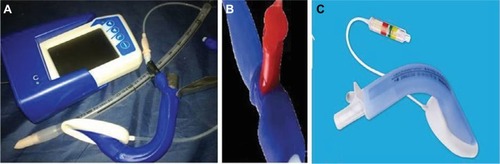 Figure 10 (A) LMA CTrach. (B) Red Plug of PLMA. (C) Baska with Integrated Cuff Pilot™.