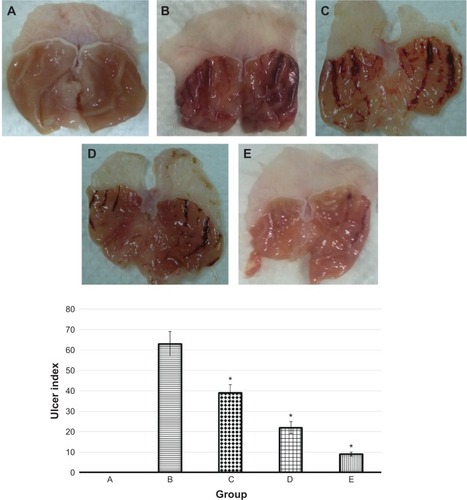 Figure 3 Gross appearances of stomach from five groups of rats, namely: (A) normal control, (B) lesion control, (C) low dose of EEAM, (D) high dose of EEAM, and (E) omeprazole control. Quantitative analysis of ulcer index showed significant reduction in the ulcer index after pretreatment with EEAM (200 mg/kg and 400 mg/kg), and omeprazole.