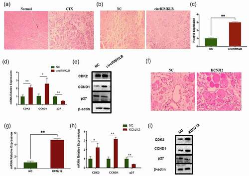 Figure 6. CircRIMKLB and KCNJ12 participate in cell cycle regulation in muscle regeneration after injury in vivo. (a) Normal and injured muscle at the tibialis anterior of the left leg of mice was checked by haematoxylin–eosin staining, 100 × . (b) The injured muscle injected with NC or circRIMKLB 2 times was checked by haematoxylin–eosin staining 3 days later, 200 × . (c) The expression efficiency of circRIMKLB was checked by qRT-PCR. (d) CDK2, CCND1 and p27 mRNA expressions of mouse tibialis anterior were detected by qRT-PCR at 3 days post-transfection. (e) CDK2, CCND1 and p27 protein levels of mouse tibialis anterior were detected by western blot at 3 days after transfection. (f) The injured muscle injected with NC or KCNJ12 was checked by haematoxylin–eosin staining 3 days later, 200 × . (g) The expression efficiency of KCNJ12 was checked by qRT-PCR. (h) CDK2, CCND1 and p27 mRNA expressions of mouse tibialis anterior were detected by qRT-PCR at 3 days post-transfection. (i) CDK2, CCND1 and p27 protein levels of mouse tibialis anterior were detected by western blot at 3 days after transfection. The relative expression levels were normalized to GAPDH. *p < 0.05; **p < 0.01.