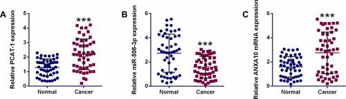 Figure 5 The expression of PCAT-1 and downstream mediators in ESCC clinical samples. qRT-PCR determination of PCAT-1 (A), miR-508-3p (B) and ANXA10 (C) mRNA expression in ESCC tissues (n = 50) and adjacent normal tissues (n = 50). ***P<0.001.