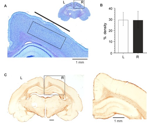 Figure 5 Neuropathological analysis of brain tissue 2 months after implantation of SCBI electrodes in the epidural space over the fronto-parietal cortex of the left hemisphere. (A) Thionine-stained sample coronal section of an electrode-implanted guinea pig brain. The boxes outline the areas utilized to perform quantitative densitometric measurements. The cortical area included in the box of the inset is illustrated at higher magnification. (B) Average data obtained by densitometric measurements (% staining density) performed on the right and left frontoparietal cortical areas (two slices per animal) in six guinea pigs chronically implanted with SCBI electrodes. (C) GFAP-stained section of a coronal section of the brain of a guinea pig implanted with SCBI electrode over the left frontoparietal cortex (and a metal epidural electrode on the right hemisphere); the boxed area is magnified on the right.