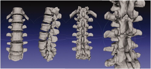 Figure 1. 3D model of the lumbar spine segmented from a CT scan.