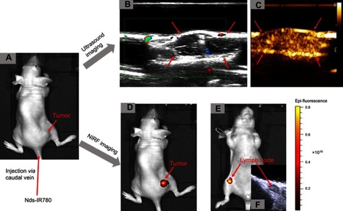 Figure 8 The detection of CMM by Nds-IR780 through dual-mode imaging in vivo. (A) A nude mouse bearing CMM. (B, C) Color Doppler flow imaging and contrast-enhanced ultrasound imaging after phase transition for CMM by Nds-IR780. (D) NIRF imaging of CMM with Nds-IR780. (E) NIRF imaging of SLNs with Nds-IR780. (F) Two-dimensional ultrasound imaging of SLNs.