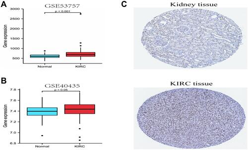 Figure 2 Assessment of SIRT7 expression levels in KIRC in the GEO database and the Human Protein Atlas. (A) Confirmation of SIRT7 mRNA upregulation in KIRC tumors relative to control tissues in the GSE53757 dataset. (B) Confirmation of SIRT7 mRNA upregulation in KIRC tumors relative to control tissues in the GSE40435 dataset. (C) SIRT7 protein levels were increased in KIRC tissues relative to control samples from the Human Protein Atlas (Antibody HPA065208, 10X).