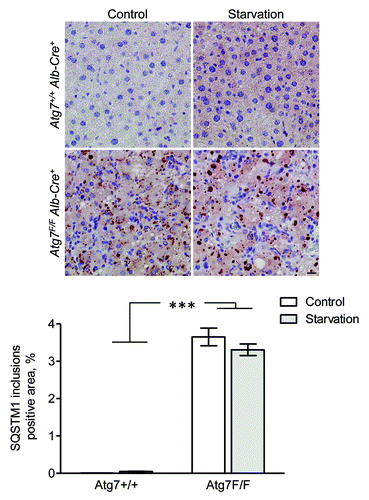 Figure 15. SQSTM1 accumulates in cytoplasmic inclusions of liver from autophagy-deficient mice. Liver samples were isolated from fed Atg7+/+ Alb-Cre+ and Atg7F/F Alb-Cre+ mice (control) or from mice that underwent starvation for 48 h. After fixation in neutral buffered formalin for 24 h, tissues were paraffin-embedded and stained for SQSTM1 using rabbit polyclonal anti-SQSTM1 (Sigma, 1:5,000) and Vectastain ABC. Heat-mediated antigen retrieval was performed in citrate buffer (pH 6.0). Scale bar, 20 μm. The positive area of SQSTM1 inclusions was quantified. ***p < 0.001 vs. Atg7+/+ Alb-Cre+ mice (two-way ANOVA, n, 10).
