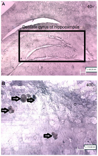 Figure 6 (A) Dentate gyrus of hippocampus of control rats (40×) (B) BrdU-positive cells in dentate gyrus of hippocampus of control rats (400×).