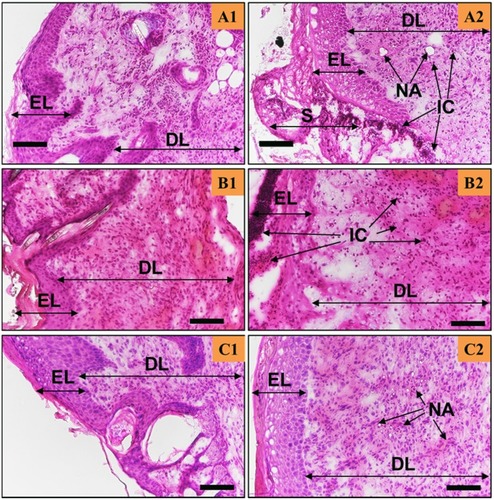 Figure 4 The H&E staining of the skin tissues at days 7, 10, and 12 post-surgery for the CG-control group. Scale bars are 100 µm. A, B, C show the staining sections at day 7, 10 12, respectively. (A1–C1) were from the areas near the wound edge and (A2–C2) were from the areas near the middle of the wounds.Abbreviations: EL, Epidermis; DL, dermis; S, scab; IC, inflammation-mediating cells; NA, neo-angiogenesis; SG, sebaceous glands.