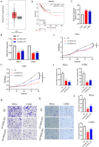 Figure 1. Expression and effect of MALAT1 on cervical cancer cells in vitro.