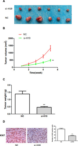 Figure 6 The effects of H19 on the growth of breast cancer cells in vivo. (A–C) H19 suppression significantly inhibited BC development in vivo, as shown by the reduction in tumor volume and weight. (D) In vivo immunohistochemical analysis shows that H19 downregulation inhibited BC development. **P < 0.01, compared with NC group.