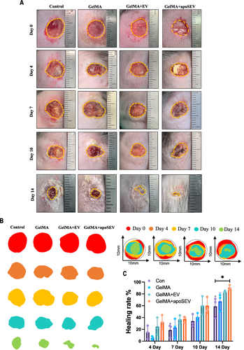 Figure 6 ApoSEV accelerates the rate of wound healing in vivo. (A) The gross view of wounds closure of Control, GelMA, GelMA+EV and GelMA+apoSEVs groups at day 0, 4, 7, 10 and 14. (B) Simulation plots of the wound closure areas at different time points and overlapped visualization groups. (C) Quantitative evaluation of the wound closure rate.The data represent the mean ±SD in the figures. Significant differences between groups are indicated as * P< 0.05.