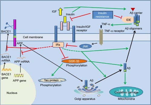 Figure 2 The underlying link between Alzheimer’s disease and type 2 diabetes mellitus.