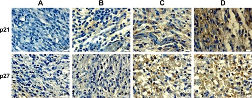Figure 8 Immunohistochemical study of cell cycle markers.