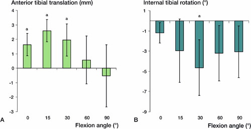 Figure 3 Change in knee kinematics after ACL reconstruction under the anterior tibial load of 130 N compared to the intact knee: A) change in anterior tibial translation, and B) change in internal tibial rotation. Error bars represent 95% confidence interval.a statistically significant difference