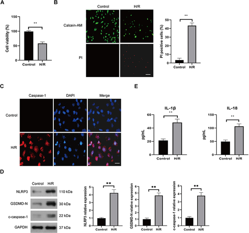 Figure 1 Effect of H/R on the pyroptotic cell death of endothelial cells. HUVECs were cultured under normal (control) conditions or subjected to hypoxia for 12 h and reoxygenation for 4 h (H/R). The viability of HUVECs was determined by the CCK-8 assay (A), the pyroptotic cell death was detected by calcein-AM/PI staining, the viable cells were stained with calcein-AM (green), whereas the dead cells were stained with PI (red), the dead cells (PI positive) were counted, Scale bar=100 μm (B), Immunofluorescence was used for detection of caspase-1, Scale bar=50 μm (C), the protein expression levels of, NLRP3, c-caspase-1, and GSDMD-N were examined by Western blot (D), the levels of secreted IL-1β and IL-18 were evaluated by ELISA (E). Data are presented as the means ± SD. **P<0.01, n=3.