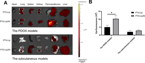 Figure 5 IVIS images of the in vivo distribution of DiD-labeled DiD-Lip/DiD-Lip2N in the PDOX/subcutaneous models of PDAC (A), and mean fluorescence intensity of tumor biodistributions (B). *p < 0.05, DiD-Lip2N versus DiD-Lip. (n=3).
