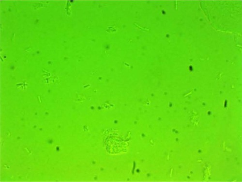 Figure 1 Clumping of lactobacilli with a matrix formation.