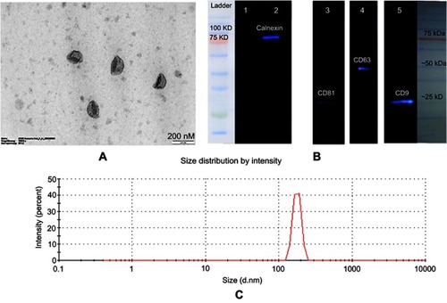 Figure 2 Characterization of exosomes. (A) TEM images of exosomes. Typical structure of exosomes was shown in this image (scale bar 200 nm). (B) Characterization of exosomes by ECL Western blotting. Exosome preparations were negative for endoplasmic reticulum marker (calnexin) in lane 1; lane 2 is the cell lysate which is positive for calnexin. The positive results for exosomal markers are displayed in lane 3 (CD81), lane 4 (CD63), and lane 5 (CD9). (C) Size distribution of exosomes was measured by a zeta-sizer. The peak diameter was about 100 nm.Abbreviations: ECL, enhanced chemiluminescence; TEM, transmission electron microscopy.