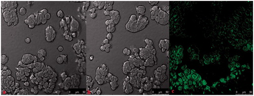 Figure 6. CLSM images of (a) control sample and (b) fluorescein-loaded nanoparticles, 0.0625 mg/mL; (c) fluorescein-loaded nanoparticles, 2 mg/mL.