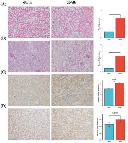 Figure 3. Pathological staining and ALOX12 expression in mouse kidney tissues. (A) H&E staining in db/m and db/db kidney tissue. (B) PAS staining in db/m and db/db kidney tissue. (C) IHC detection of NGAL protein expression in db/m and db/db kidney tissue. (D) IHC detection of ALOX12 protein expression in db/m and db/db kidney tissues. Scale bar = 50 μm. *p < .05, **p < .01.