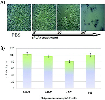 Figure 1. (A) Kinetics of MDCK II cells treatment with sPLA2 (1.5 × 10−6 mol L−1 and Trypan blue staining at 30 min). (B) In vitro cytotoxic effect of pure sPLA2 (0.5 to 1.5 × 10−6 mol L−1 on MDCK II cells after two hours of exposure to different snake venom sPLA2 concentrations. Cell viability is determined by MTT assay (the MTT value of control sample exposed only to PBS buffer is defined as 100% viability). Data from the experiments performed in triplicate are expressed as mean ± SD.