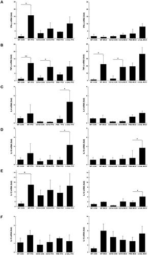 Figure 4. Both FFD and MCD diets increase hepatic proinflammatory cytokine production Hepatic mRNA expression of IFN-γ(A), TNF-α(B), IL-4 (C), IL-10 (D), IL-12 (E) and IL-15 (F) was detected by RT-qPCR. The data are presented as mean ± SD (n = 5 per group). *p < .05, **p < .01.