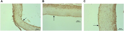 Figure 6. Representative light microscopy of control, 24-month-old and agmatine-treated 24-month-old groups in the endothelium of the aorta. Decreased eNOS (arrows) (b) immunoreactivity in the aorta in 24-month-old rats compared to 4-month-old controls (a) and increased eNOS (c) immunoreactivity in endothelial tissue in the agmatine-treated 24-month-old group compared to 24-month-old groups (b). Scale bars: 20 μm.