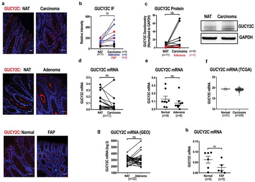 Figure 2. Retention of GUCY2C expression in tumors in human colorectum.(a-c) GUCY2C protein quantified by (a-b) immunofluorescence or (c) immunoblot (canonical doublet at 140–160 kDa) in adenocarcinomas (sporadic and FAP) and adenomas and normal mucosa. Where appropriate, matched normal adjacent tissues (NAT) and tumors from the same patient are highlighted with a connecting line. (d) GUCY2C mRNA quantified by RT-PCR in adenocarcinomas and matched normal mucosa (n = 17). (e) GUCY2C mRNA quantified by RT-PCR analysis in tubular adenomas (n = 8) and normal mucosa (n = 9). (f) GUCY2C mRNA expression quantified by RNASeq in carcinomas (n = 339) and normal mucosa (n = 51) from human colorectum from the TCGA database.Citation36 (g) GUCY2C mRNA expression quantified by RNASeq in adenomas and matched normal mucosa (n = 32) from the human colorectum from a GEO dataset (accession number GSE8671).Citation37-Citation39 (h) GUCY2C mRNA quantified by RT-PCR analysis in FAP adenomas (n = 5) and normal mucosa (n = 6). Red, GUCY2C; blue, DAPI. ns, not significant. Scale bar = 100 µm.