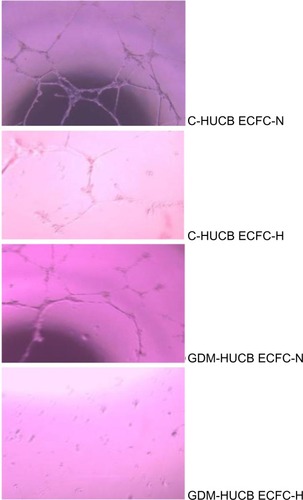 Figure 6 Photomicrographs representing matrigel assay against chronic hypoxia, which represents the vessel-forming ability.