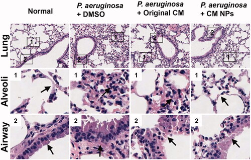 Figure 8. Lung tissue injuries and immune cells infiltrations were assessed by H&E staining.