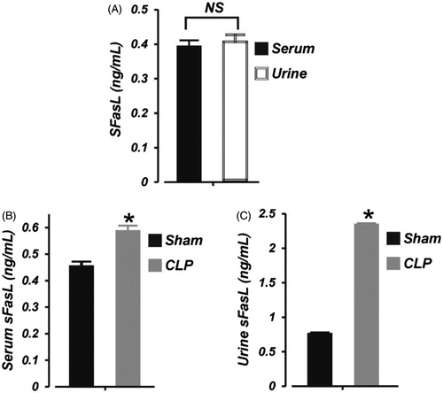 Figure 3. Early polymicrobial sepsis increases serum and urine sFasL in neonatal pigs. Mean data showing: (A) basal sFasL levels (ELISA) in the serum and urine of neonatal pigs (n = 6), (B) serum sFasL concentration in sham-operated (6 h; n = 6) and septic (6 h; n = 7) neonatal pigs, and (C) urine sFasL concentration in sham-operated (6 h; n = 6) and septic (6 h; n = 7) neonatal pigs. *p < .05 versus Sham. NS: not significant.
