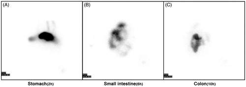 Figure 12. Scintigraphic imaging. SPECT scan on mini-pigs' stomach, small intestine and colon at 2 h (A), 6 h (B) and 10 h (C), respectively, after oral delivery of 99mTc-labeled Tat-CS-NPs (n = 3).