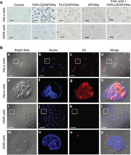 Figure 8 HeLa cells and A549 cells treated with various contrast agents.Notes: In vitro Prussian blue staining images of controls of HeLa cells and A549 cells and images of these cells after treatment with FAPLCS/SPIONs, PLCS/SPIONs, SPIONs, and free folic acid-combined FAPLCS/SPIONs (A). Confocal laser scanning microscopy of cells treated with DiI-loaded FAPLCS/SPIONs: HeLa (a–d; corresponding high magnification images shown in e–h) and A549 (i–l; corresponding high magnification images shown in panels m–p) (B). Scale bar =20 μm.Abbreviations: FAPLCS, folate-conjugated N-palmitoyl chitosan; SPION, superparamagnetic iron oxide nanoparticle; PLCS, N-palmitoyl chitosan; DiI, 1,1′-dioctadecyl-3,3,3′,3′-tetramethylindocarbocyanine perchlorate.