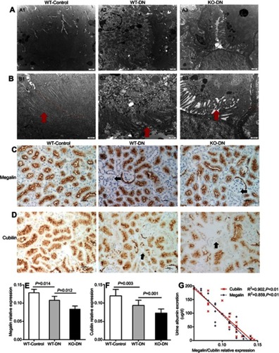 Figure 4 Expression of megalin, cubilin, and A1 adenosine receptor (A1AR) in kidneys of DN patients. (A) A1AR was located at the membrane of PTC by immunofluorescent staining. Green: A1AR; Blue: DAPI; Merge is A1AR with DAPI. (B) Megalin was visualized at the brush border of proximal tubular cells (PTC) in patients with diabetic nephropathy (DN) by immunofluorescent staining. Green: megalin; Blue: DAPI, Merge is megalin with DAPI. (C) Showed the coexpression of A1AR and megalin at PTC. Green: A1AR; Red: megalin; Blue: DAPI; Merge is A1AR with megalin. (D–E) Semiquantitative analysis of immunohistochemical staining showed the positive area of both megalin and cubilin expression decreased significantly in DN patients compared to that in GML patients. (F) Negative association of megalin positive expression area and 24 hrs urine protein in DN patients. Data are presented as the Mean ± SEM (n=12 per group). Bar width: 25 μm. The red arrows in panels D and E were megalin loss area.