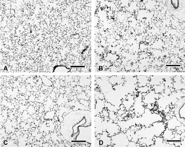 Figure 2 Left lung parenchyma from female B6C3F1 (A, B) and A/J mice (C, D) exposed to filtered air (A, C) or cigarette smoke (B, D) for 15 weeks. Note that cigarette smoke exposure in both strains is associated with widespread but irregular alveolar and alveolar ductal air space expansion. Severity of the change is qualitatively less in the cigarette smoke-exposed B6C3F1 mice. Similar changes are present in the male animals (not shown). Bars = 200 µm.