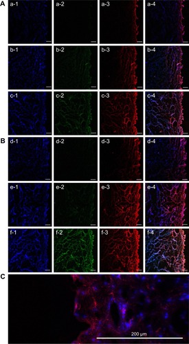 Figure 6 Confocal laser scanning microscopy of mucosa after treatment for 2 and 4 hours.Notes: (A) After 2-hour treatment with (a) RF-IPC-NVs, (b) RF-INS-DNVs, and (c) RF-IPC-DNVs. (B) After 4-hour treatment with (d) RF-IPC-NVs, (e) RF-INS-DNVs, and (f) RF-IPC-DNVs. (C) Magnified mucosa after 2-hour treatment with R-IPC-DNVs. −1 refers to the channels of DAPI; −2 refers to the channels of FITC; −3 refers to the channels of rhodamine I; −4 refers to the merged image. The bar of A and B is 100 µm.Abbreviations: DAPI, 4′,6-diamidino-2-phenylindole; DNVs, deformable nanovesicles; FITC, fluorescein isothiocyanate; INS, insulin; IPC, insulin-phospholipid complex; NVs, conventional nanovesicles; RF, rhodamine-labeled phospholipid and FITC-labeled insulin.