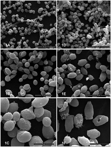 Figure 2. Effects of BTME on C. albicans. (a–c) Control cells; (d–f) cells treated with BTME at MIC for 12 h. (a–c) Ultrastructural aspects of untreated C. albicans culture at low (a) and high magnification (b–c) showing the presence of single and budding yeast cells with evident fragile blastoconidial septum (white arrow). (h) True hyphal structures could be also observed. Treated C. albicans culture at (d) low and (e–f) high magnifications. Note in (e) the presence of elongated cells (white asterisk) with multiple scars (white arrow). (f) Cells presenting surface depressions are indicated in white arrow.